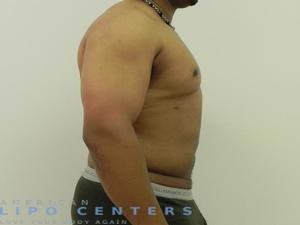 americanlipocenters_205.jpg